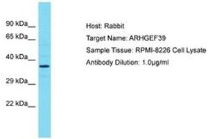 Image no. 1 for anti-Chromosome 9 Open Reading Frame 100 (C9orf100) (N-Term) antibody (ABIN6750708)