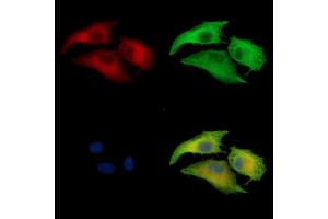 ABIN7095039 and ABIN7099095 staining  cells by IF/ICC.