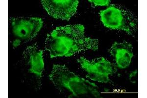 Image no. 1 for anti-Mitochondrial Ribosomal Protein L12 (MRPL12) (AA 1-199) antibody (ABIN598585) (MRPL12 antibody  (AA 1-199))