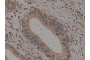 Immunohistochemistry (IHC) image for anti-Nucleoporin 210kDa (NUP210) (AA 1288-1449) antibody (ABIN7442474)