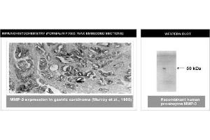 Immunohistochemistry (IHC) image for anti-Matrix Metallopeptidase 3 (Stromelysin 1, Progelatinase) (MMP3) (C-Term) antibody (ABIN264506)