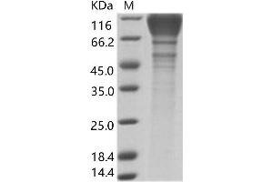 Western Blotting (WB) image for Human Immunodeficiency Virus 1 Surface Glycoprotein (HIV-1 gp120) protein (His tag) (ABIN7196133) (GP120 Protein (His tag))