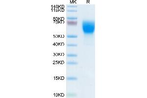 L-Selectin Protein (AA 39-332) (His tag)