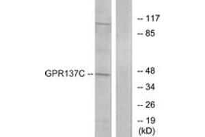 Western blot analysis of extracts from HepG2 cells, using GPR137C Antibody. (GPR137C antibody  (AA 256-305))