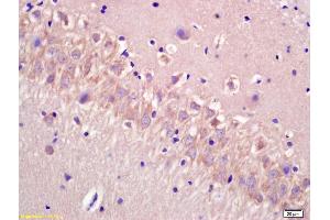 Formalin-fixed and paraffin embedded rat brain labeled with Anti-CECR5 Polyclonal Antibody, Unconjugated (ABIN872871) at 1:200 followed by conjugation to the secondary antibody and DAB staining. (CECR5 antibody  (AA 251-350))