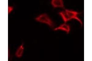 ABIN6269122 staining NIH-3T3 by IF/ICC. (c-MET antibody  (C-Term))