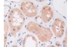 Immunohistochemistry (IHC) image for anti-Phosphoinositide-3-Kinase, Catalytic, beta Polypeptide (PIK3CB) (AA 807-1070) antibody (ABIN7437749)