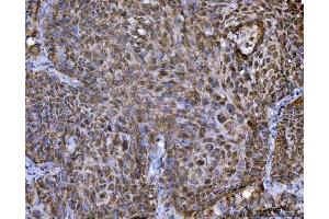 IHC analysis of TRBP/TARBP2 using anti-TRBP/TARBP2 antibody (ABIN7600548). (TARBP2 antibody  (AA 20-366))