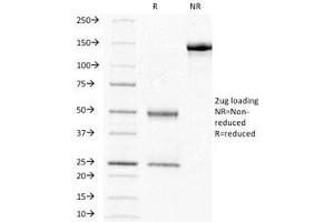 SDS-PAGE Analysis of Purified, BSA-Free HCG-beta Antibody (clone HCGb/211). (HCG beta antibody)