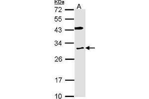 WB Image Sample (30 ug of whole cell lysate) A: H1299 12% SDS PAGE antibody diluted at 1:1000 (Cytochrome B Reductase 1 antibody  (C-Term))