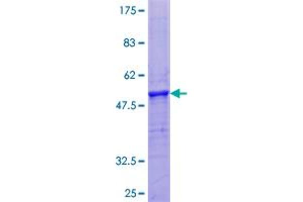 PROC Protein (AA 1-166) (GST tag)
