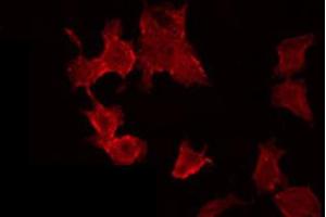 ABIN6272400 staining MCF7 by IF/ICC. (POTE-14/22 antibody)