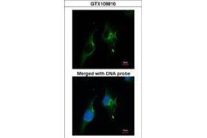 Image no. 2 for anti-Natriuretic Peptide Receptor A/guanylate Cyclase A (Atrionatriuretic Peptide Receptor A) (NPR1) (AA 640-886) antibody (ABIN467522) (NPR1 antibody  (AA 640-886))