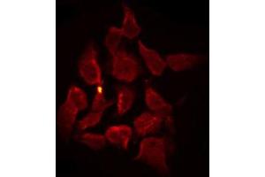 ABIN6267263 staining SK-OV3 by IF/ICC. (EGFR antibody  (pTyr1110))