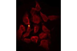 ABIN6267263 staining SK-OV3 by IF/ICC. (EGFR antibody  (pTyr1110))