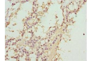 ABCC11 antibody  (AA 1-170)