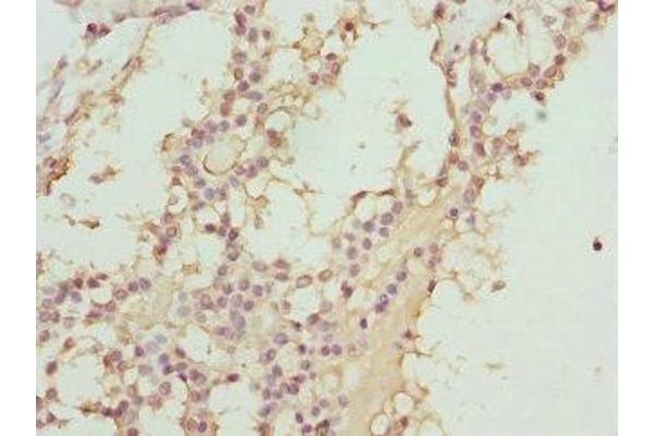 ABCC11 antibody  (AA 1-170)