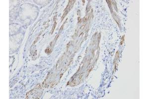 IHC-P Image Immunohistochemical analysis of paraffin-embedded human smooth muscle, using GOLGA5, antibody at 1:100 dilution. (GOLGA5 antibody)