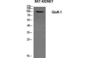 Western Blot (WB) analysis of specific cells using GluR-1 Polyclonal Antibody. (Glutamate Receptor 1 antibody  (Ser43))