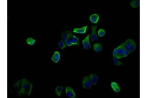 Immunofluorescence staining of MCF-7 cells with ABIN7163222 at 1:100, counter-stained with DAPI. (PIGQ antibody  (AA 616-760))