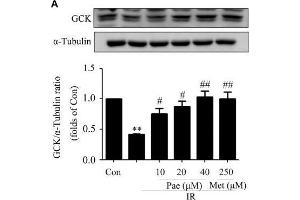 Paeonol regulated the phosphorylation of Akt and the protein contents of GCK and LDLR in insulin-resistant HepG2 cells. (GCK antibody  (AA 1-300))