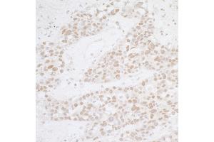 Immunohistochemistry (IHC) image for anti-Activating Transcription Factor 1 (AFT1) (AA 1-50) antibody (ABIN7454893) (AFT1 antibody  (AA 1-50))