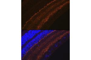 Immunofluorescence analysis of rat retina using G Rabbit mAb (ABIN7267515) at dilution of 1:100 (40x lens). (GAP43 antibody)