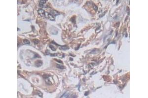 Figure. (PKN2 antibody  (AA 323-464))