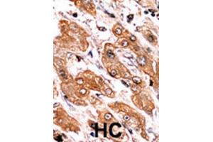 Immunohistochemistry (IHC) image for anti-BCL2-Interacting Killer (Apoptosis-Inducing) (BIK) (pThr33) antibody (ABIN2970932) (BIK antibody  (pThr33))