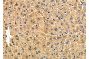 ABIN6264567 and ABIN6276965 at 1/100 staining Mouse liver tissue by IHC-P.