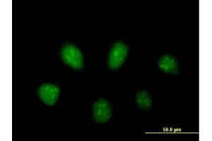 Immunofluorescence of purified MaxPab antibody to PARP3 on HeLa cell. (PARP3 antibody  (AA 1-533))