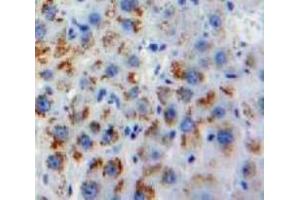 Used in DAB staining on fromalin fixed paraffin-embedded Liver tissue (Melatonin Receptor 1A antibody  (AA 300-353))