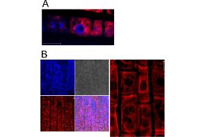 Image no. 2 for anti-Heat Shock 70kDa Protein 5 (Glucose-Regulated Protein, 78kDa) (HSPA5) antibody (ABIN349665) (GRP78 antibody)