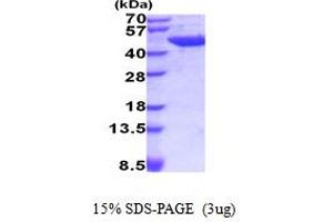 SDS-PAGE (SDS) image for Aminoacylase 1 (ACY1) (AA 1-408) protein (His tag) (ABIN6387611) (Aminoacylase 1 Protein (ACY1) (AA 1-408) (His tag))