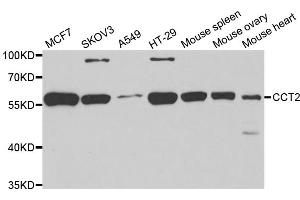 Western blot analysis of extracts of various cell lines, using CCT2 antibody (ABIN5973929) at 1/1000 dilution. (CCT2 antibody)