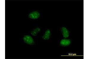 Immunofluorescence of purified MaxPab antibody to ALS2CR15 on HeLa cell. (ICA1L antibody  (AA 1-482))