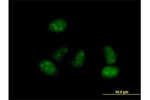 Immunofluorescence of purified MaxPab antibody to ALS2CR15 on HeLa cell. (ICA1L antibody  (AA 1-482))