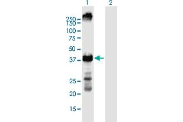 KCNA2 antibody  (AA 1-356)