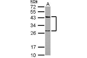 Western Blotting (WB) image for anti-Twinfilin, Actin-Binding Protein 1 (TWF1) (AA 14-208) antibody (ABIN1501587) (TWF1 antibody  (AA 14-208))