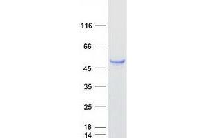 Western Blotting (WB) image for Adhesion Regulating Molecule 1 (Adrm1) (Transcript Variant 2) protein (Myc-DYKDDDDK Tag) (ABIN2714436)