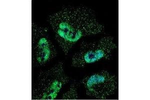Confocal immunofluorescent analysis of HuR antibody with NCI-H460 cells followed by Alexa Fluor 488-conjugated goat anti-mouse lgG (green). (ELAVL1 antibody)