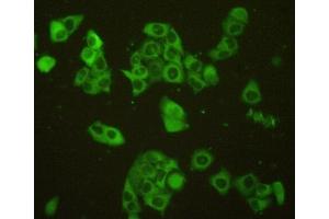 Detection of Sp100 in MCF7 cells using Polyclonal Antibody to Sp100 Nuclear Antigen (Sp100) (SP100 antibody  (AA 610-802))