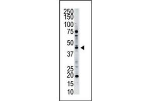 Image no. 1 for anti-Nucleoside Diphosphate Kinase (NME7) (N-Term) antibody (ABIN360548) (NME7 antibody  (N-Term))