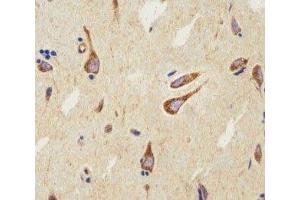 IHC analysis of FFPE human brain using CB2 antibody at 1:25. (CNR2 antibody  (AA 329-356))