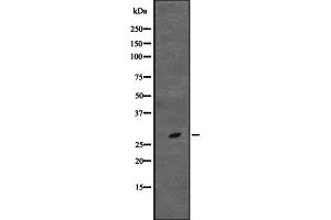 Western blot analysis of CD48 expression in Jurkat cell lysate,The lane on the left is treated with the antigen-specific peptide. (CD48 antibody  (Internal Region))