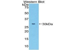 Detection of Recombinant vWA1, Rat using Polyclonal Antibody to Von Willebrand Factor A Domain Containing Protein 1 (vWA1) (VWA1 antibody  (AA 43-285))