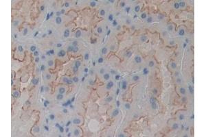 Immunohistochemistry (IHC) image for anti-Actinin, alpha 4 (ACTN4) (AA 1-269) antibody (ABIN7440797)