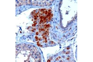 ABIN185714 (3µg/ml) staining of paraffin embedded Human Testis. (SECISBP2 antibody  (Internal Region))