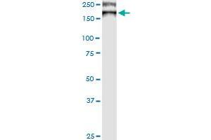 ATP7B antibody  (AA 1372-1465)