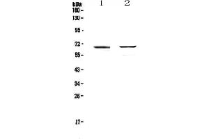 Western blot analysis of RUNX1T1/ETO using anti-RUNX1T1/ETO antibody .
